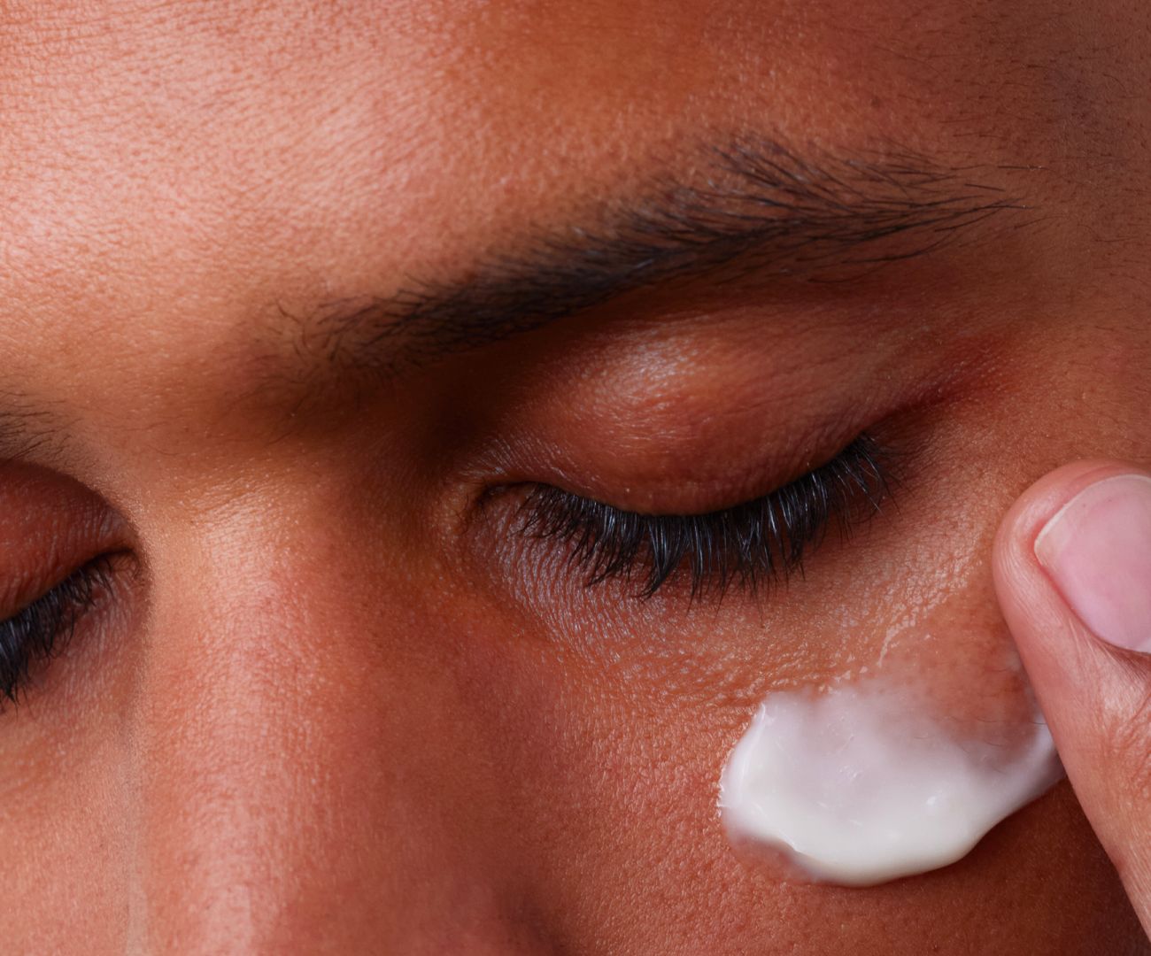 What is a combination skin ?